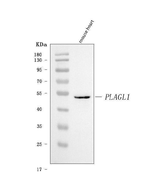  Western blot analysis of ZAC/Plagl1 using anti-ZAC/Plagl1 antibody (A03220-2)