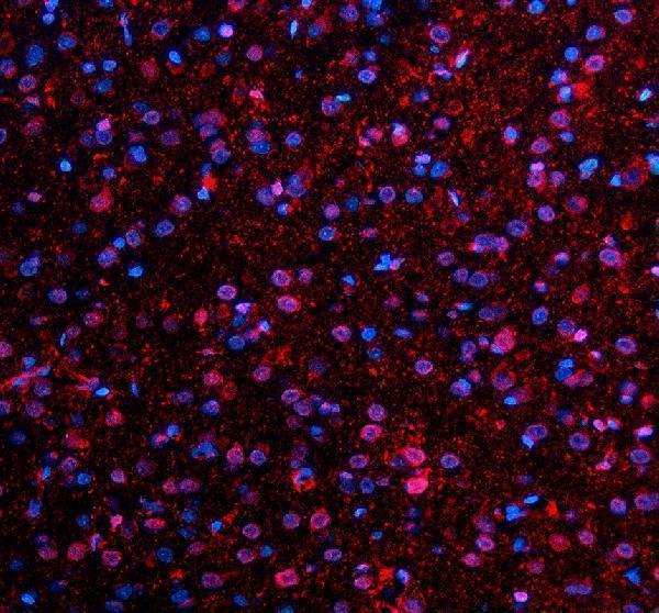 IF analysis of NMNAT1 using anti-NMNAT1 antibody (A03221-1)