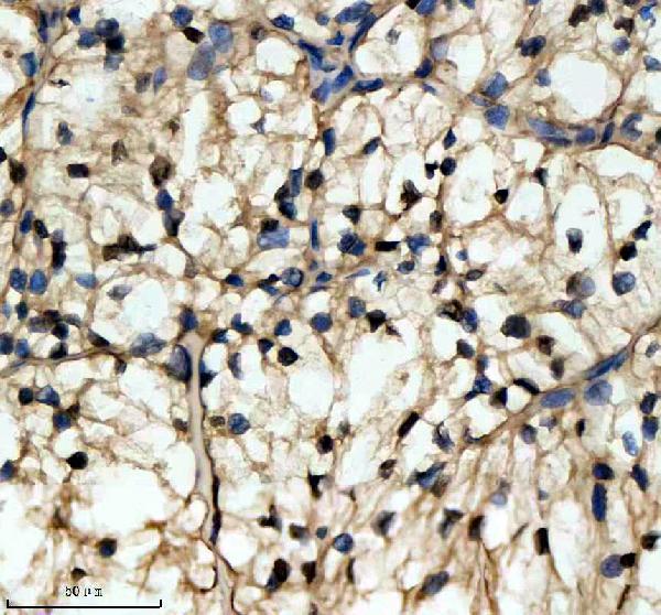 IHC analysis of NMNAT1 using anti-NMNAT1 antibody (A03221-1)