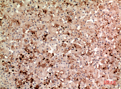 Immunohistochemical analysis of paraffin-embedded human-liver, antibody was diluted at 1:100