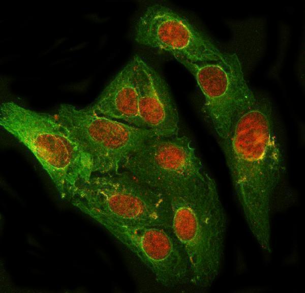 a03223 2 prdm2 primary antibodies if testing 6