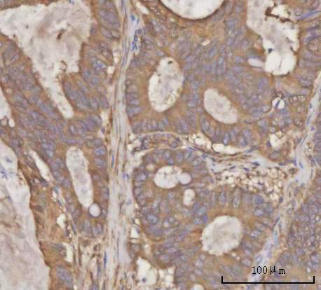  IHC analysis of PRDM2 using anti-PRDM2 antibody (A03223-2)