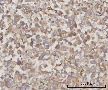  IHC analysis of PRDM2 using anti-PRDM2 antibody (A03223-2)