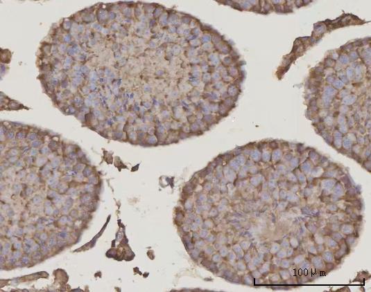 a03223 2 prdm2 primary antibodies ihc testing 4