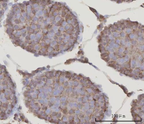 a03223 2 prdm2 primary antibodies ihc testing 5