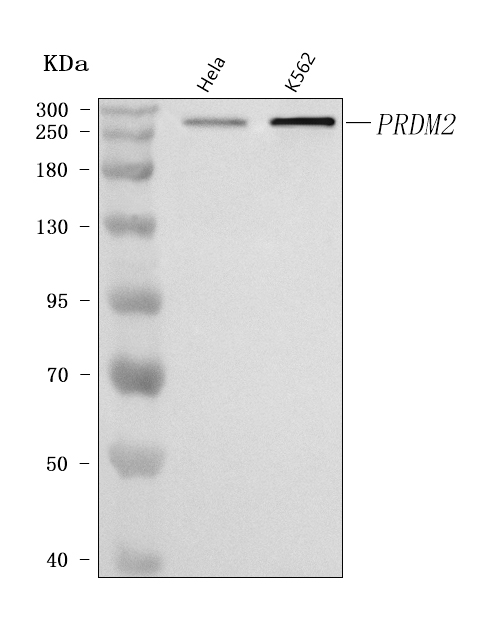  Western blot analysis of PRDM2 using anti-PRDM2 antibody (A03223-2)