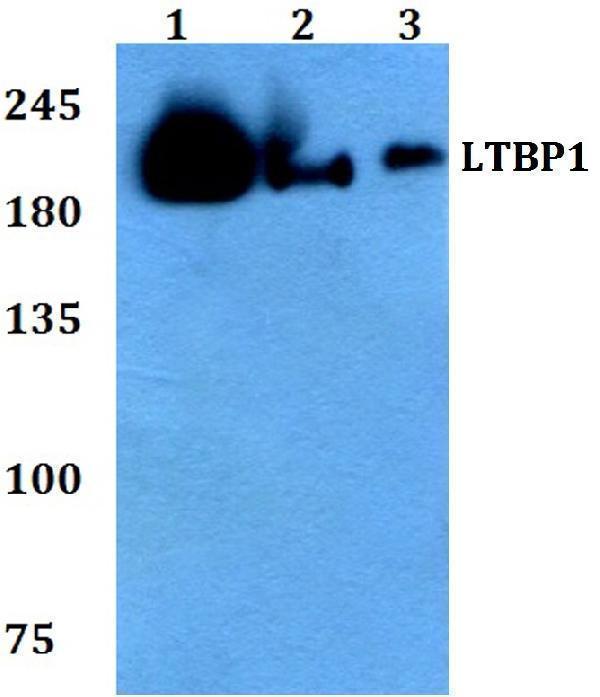 a03224 ltbp1 primary antiboties wb testing 1