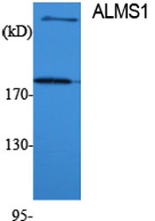Western Blot analysis of various cells using ALMS1 Polyclonal Antibody