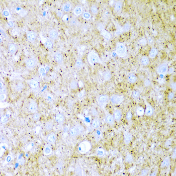 Immunohistochemistry of paraffin-embedded rat brain using WNT2 antibody  at dilution of 1:200 