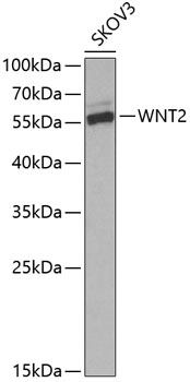 Western blot analysis of extracts of SKOV3 cells, using WNT2 Antibody  at 1:1000 dilution