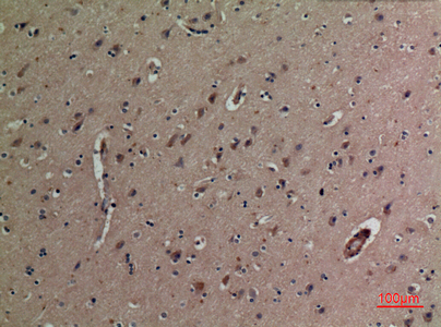 Immunohistochemical analysis of paraffin-embedded human-brain, antibody was diluted at 1:100