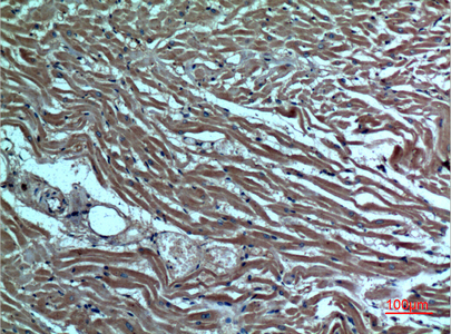 Immunohistochemical analysis of paraffin-embedded human-heart, antibody was diluted at 1:100