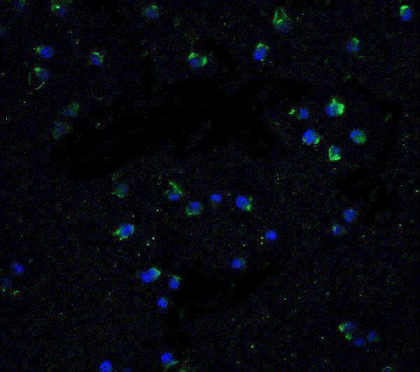 Immunofluorescence of DR3 in Jurkat cells with DR3 antibody at 20 μg/mL