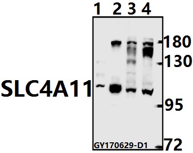 a03228 slc4a11 primary antiboties wb testing 1