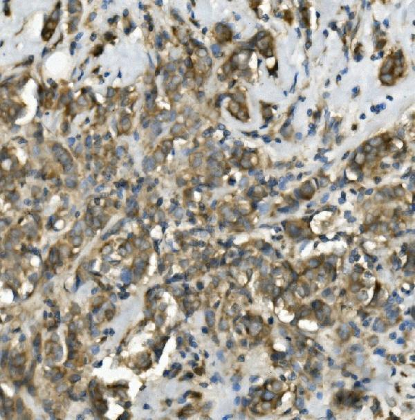 a03232 1 trim25 primary antibodies ihc testing 3