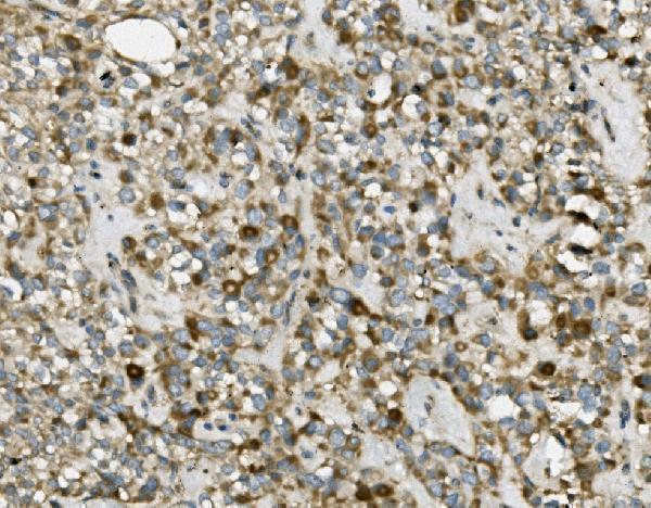 a03232 1 trim25 primary antibodies ihc testing 4