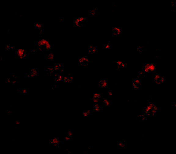 a03232 2 trim25 primary antibodies if testing 3