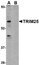 a03232 2 trim25 primary antibodies wb testing 1