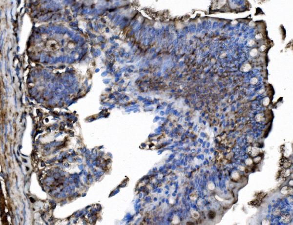 a03232 4 trim25 primary antibodies ihc testing 3