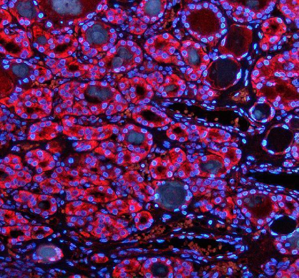a03233 1 shmt2 primary antibodies if testing 2