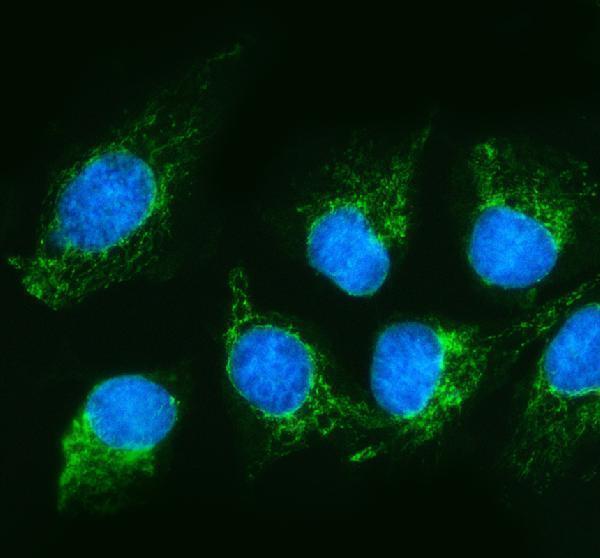 a03233 1 shmt2 primary antibodies if testing 3