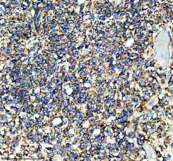 a03233 1 shmt2 primary antibodies ihc testing 10