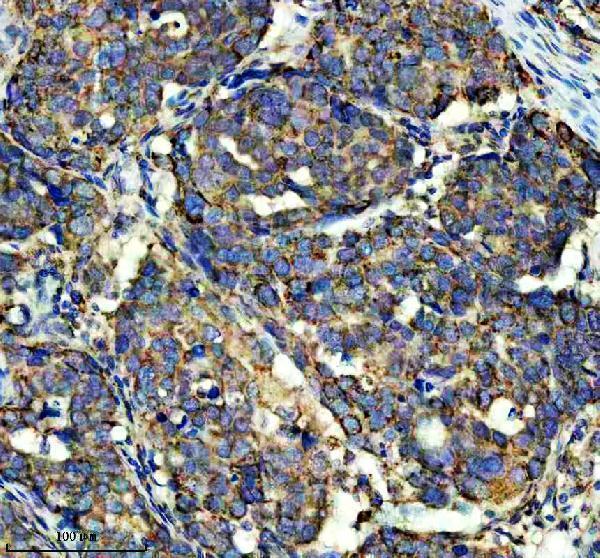 a03233 1 shmt2 primary antibodies ihc testing 11