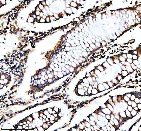 a03233 1 shmt2 primary antibodies ihc testing 12