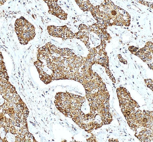 a03233 1 shmt2 primary antibodies ihc testing 13