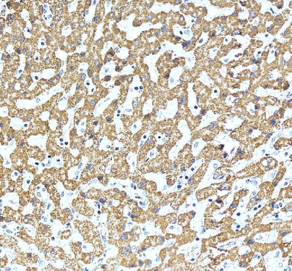 a03233 1 shmt2 primary antibodies ihc testing 14