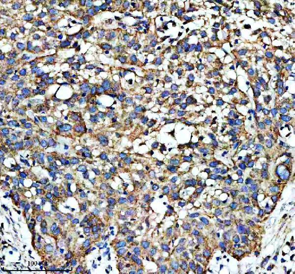 a03233 1 shmt2 primary antibodies ihc testing 2