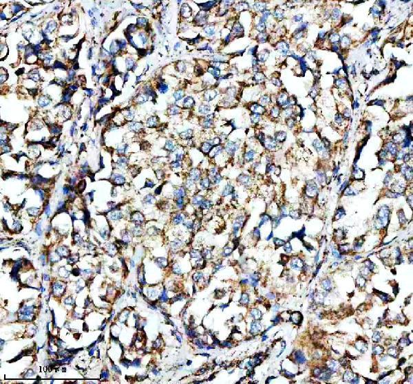 a03233 1 shmt2 primary antibodies ihc testing 3