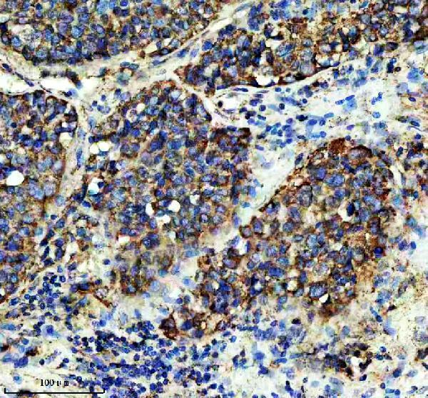 a03233 1 shmt2 primary antibodies ihc testing 4