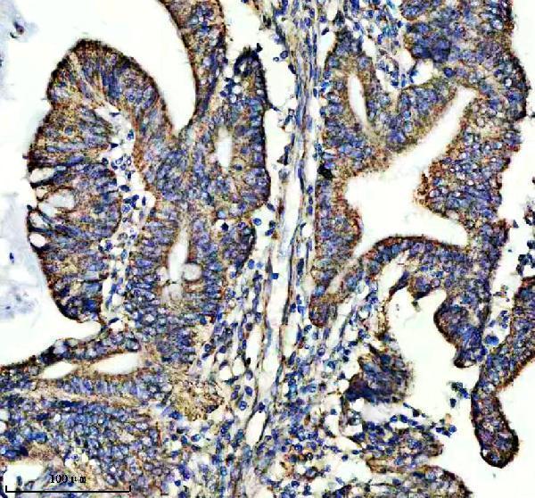 a03233 1 shmt2 primary antibodies ihc testing 5
