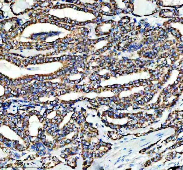 a03233 1 shmt2 primary antibodies ihc testing 6