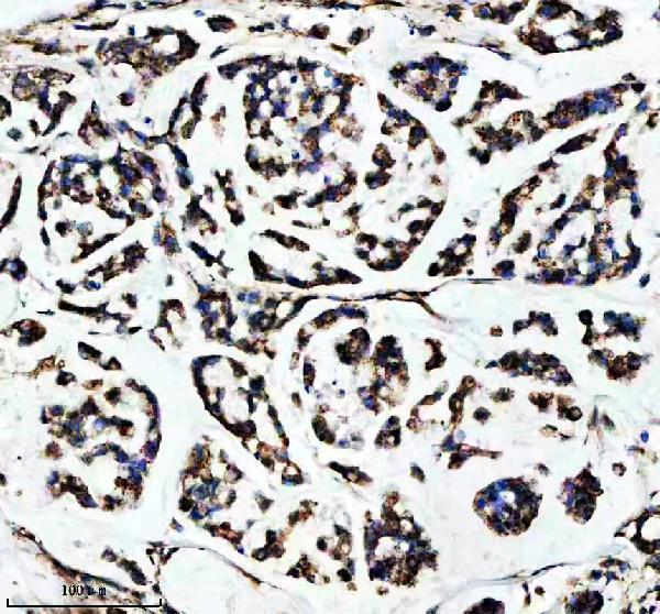 a03233 1 shmt2 primary antibodies ihc testing 7