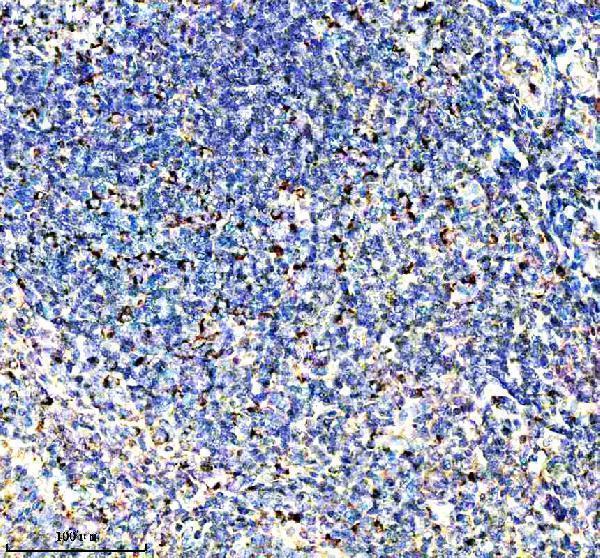 a03233 1 shmt2 primary antibodies ihc testing 8