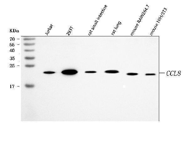  Western blot analysis of MCP2/CCL8 using anti-MCP2/CCL8 antibody (A03237-2)