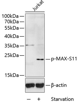 Western blot analysis of extracts of Jurkat cells, using Phospho-MAX-S11 antibody  at 1:1000 dilution