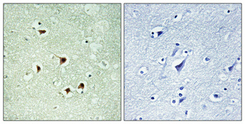 Immunohistochemical analysis of paraffin-embedded Human brain
