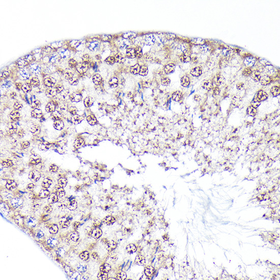 a03240 2 peg10 primary antiboties ihc testing 2