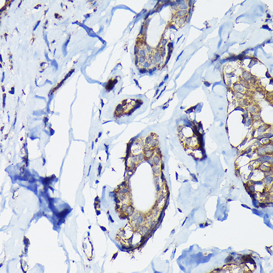 a03240 2 peg10 primary antiboties ihc testing 3