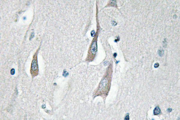 a03241t286 camk2a primary antiboties ihc testing 2