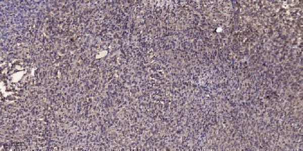 a03242 1 slc38a2 primary antibodies ihc testing 1