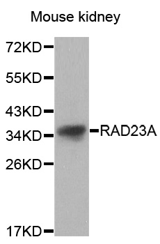 Western blot analysis of Rad23A polyclonal antibody