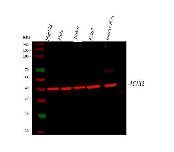 a03245 1 acat2 primary antibodies wb testing 1_1