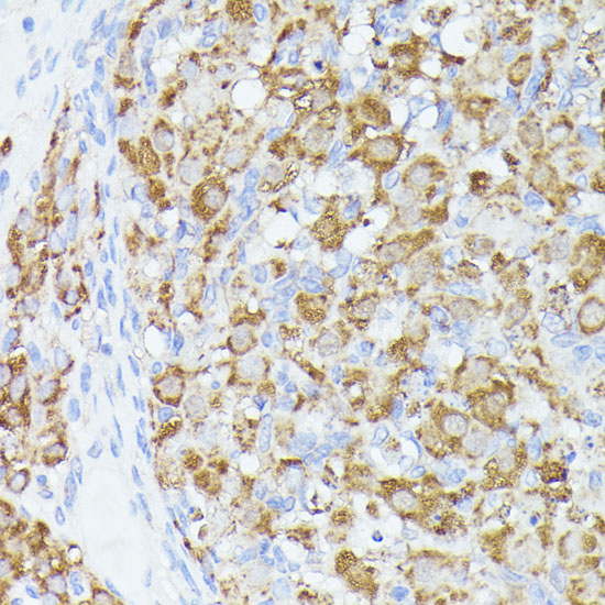 Immunohistochemistry of paraffin-embedded rat ovary using ACAT2 antibody  at dilution of 1:100 
