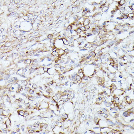 a03245 acat2 primary antiboties ihc testing 4