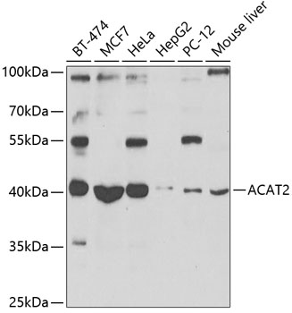 Western blot analysis of extracts of various cell lines, using ACAT2 antibody  at 1:1000 dilution