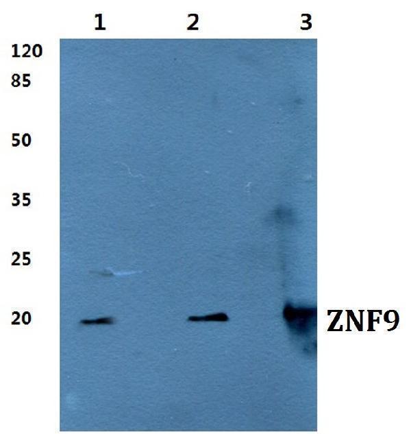 Western blot (WB) analysis of ZNF9 polyclonal antibody at 1:500 dilution
Lane1:MCF-7 cell lysate
Lane2:Raw264